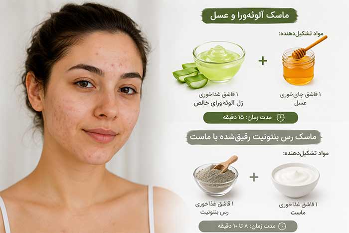 پوست سالم ماسک آلويه ورا و عسل / ماسک رس بنتونیت رقیقشده با ماست